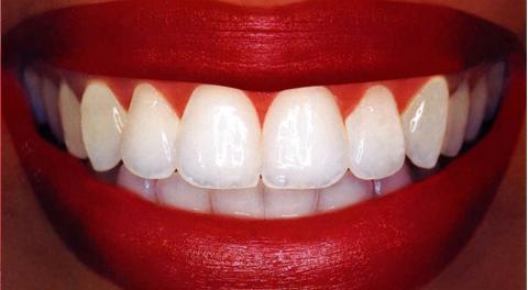 How To Have Natural White Teeth